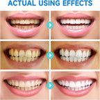 LumaPure™ — Unlock a Radiant Smile and Pain-Free Gums Every Day