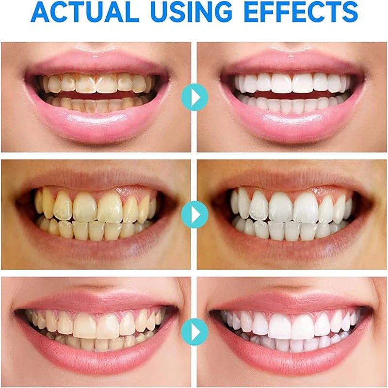 LustraShine™ — Ignite Unstoppable Confidence with a Brilliant, Fresh Smile Every Day (1+1 FREE TODAY!)