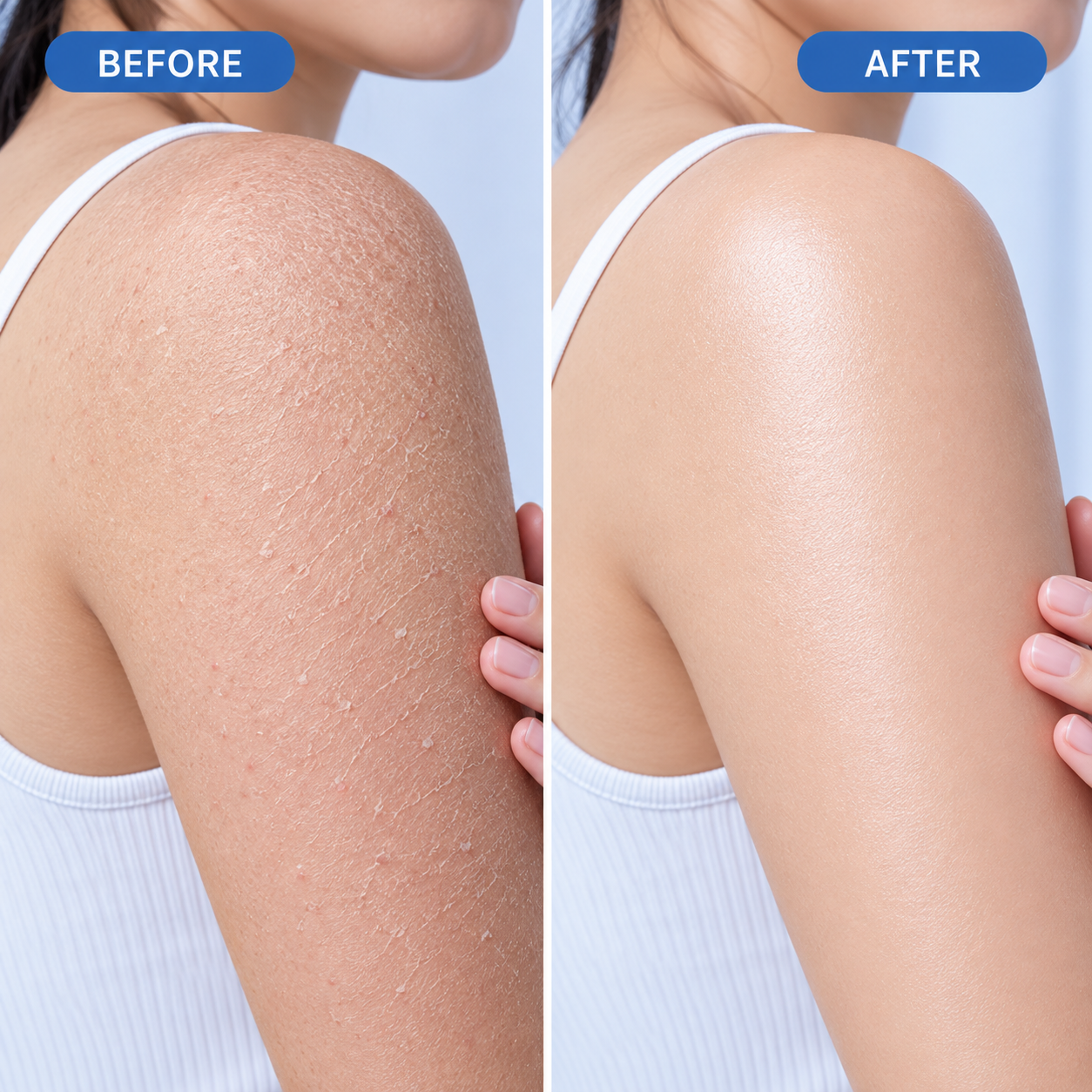 Exfolivelle™ Exfoliating Scrub Pads 8pcs— Instantly Smooth Away Rough Skin for Radiant, Touchable Confidence