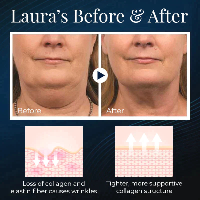 VivaLift™ — Wake Up to a Naturally Sculpted, Youthful Jawline Without Effort