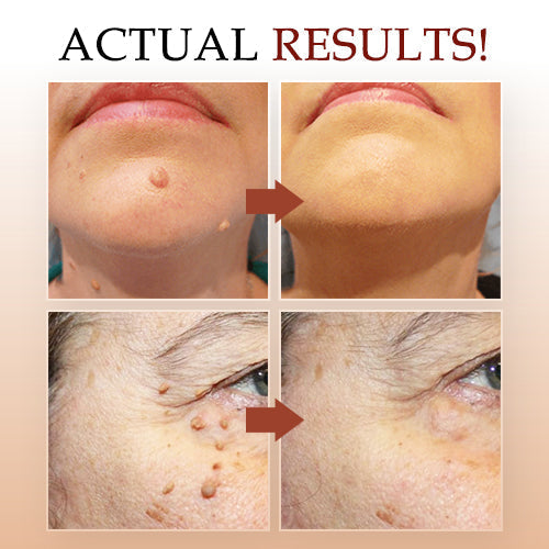 GlowClear™ — Reveal Soft, Spotless Skin That Lights Up Every Room (1+1 FREE!)