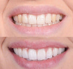 LuminaBright™ — Light Up Your Smile Instantly with Gentle, Healthy Whitening