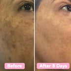 RamoraBright™ — Reveal Your Radiant Glow by Fading Dark Spots Fast