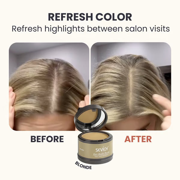 VivaRoot™ — Instantly Transform Your Hairline and Own Every Room
