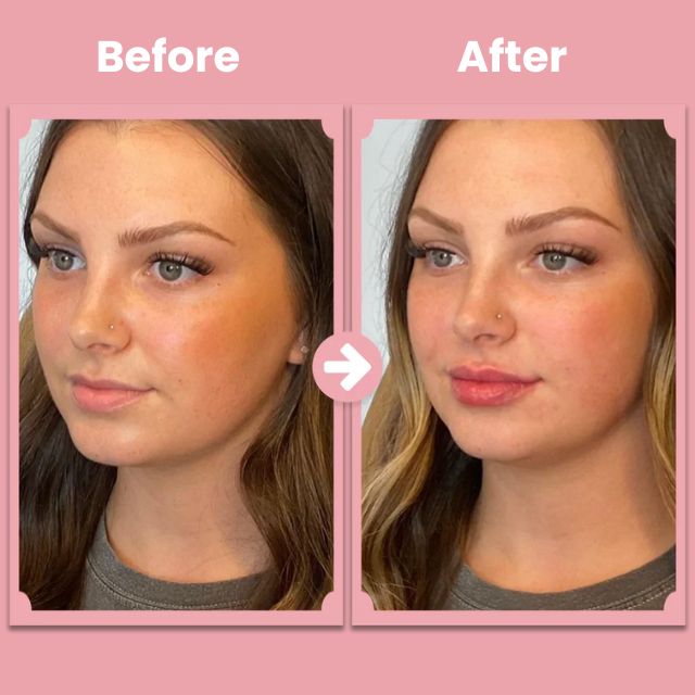 PlumpAura™ — Ignite Natural Fullness for Soft, Irresistible Lips Every Day