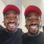 GlissaSmile™ — Instantly Own a Radiant, Head-Turning Smile Without Any Hassle