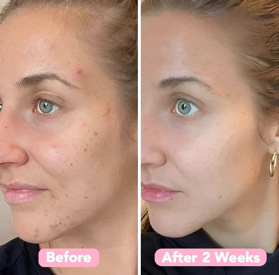 TurmeriLuxe™ — Unlock Your Skin’s Calm, Clear, and Radiant Glow Every Day