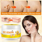 VeloraMist™ — Fade Stubborn Moles & Warts Naturally While Nourishing Healthier-Looking Skin