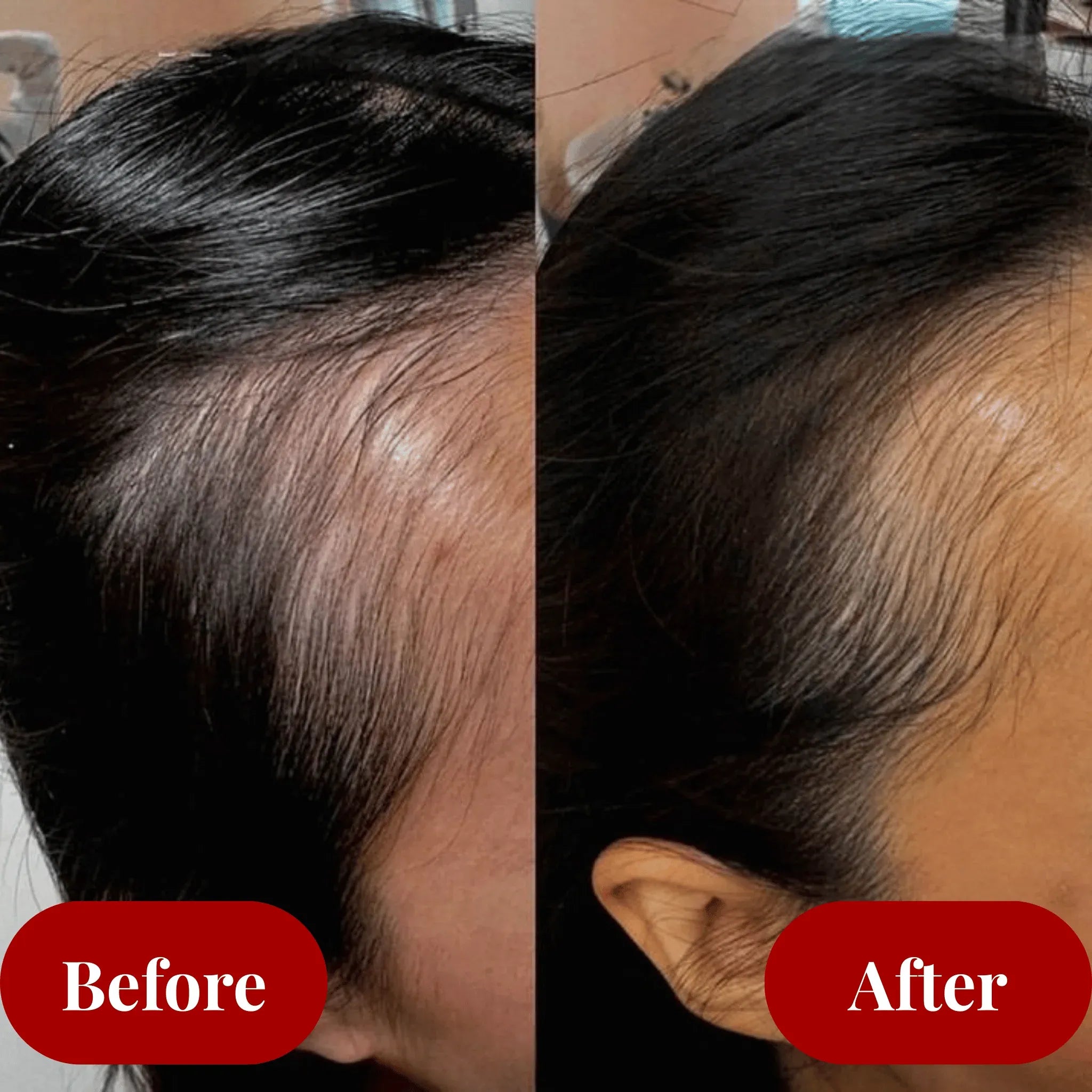 VitaThrive™ Hair Elixir — Unlock Thicker, Fuller Hair That Commands Attention